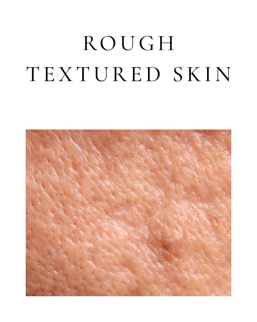 Rough Textured Skin