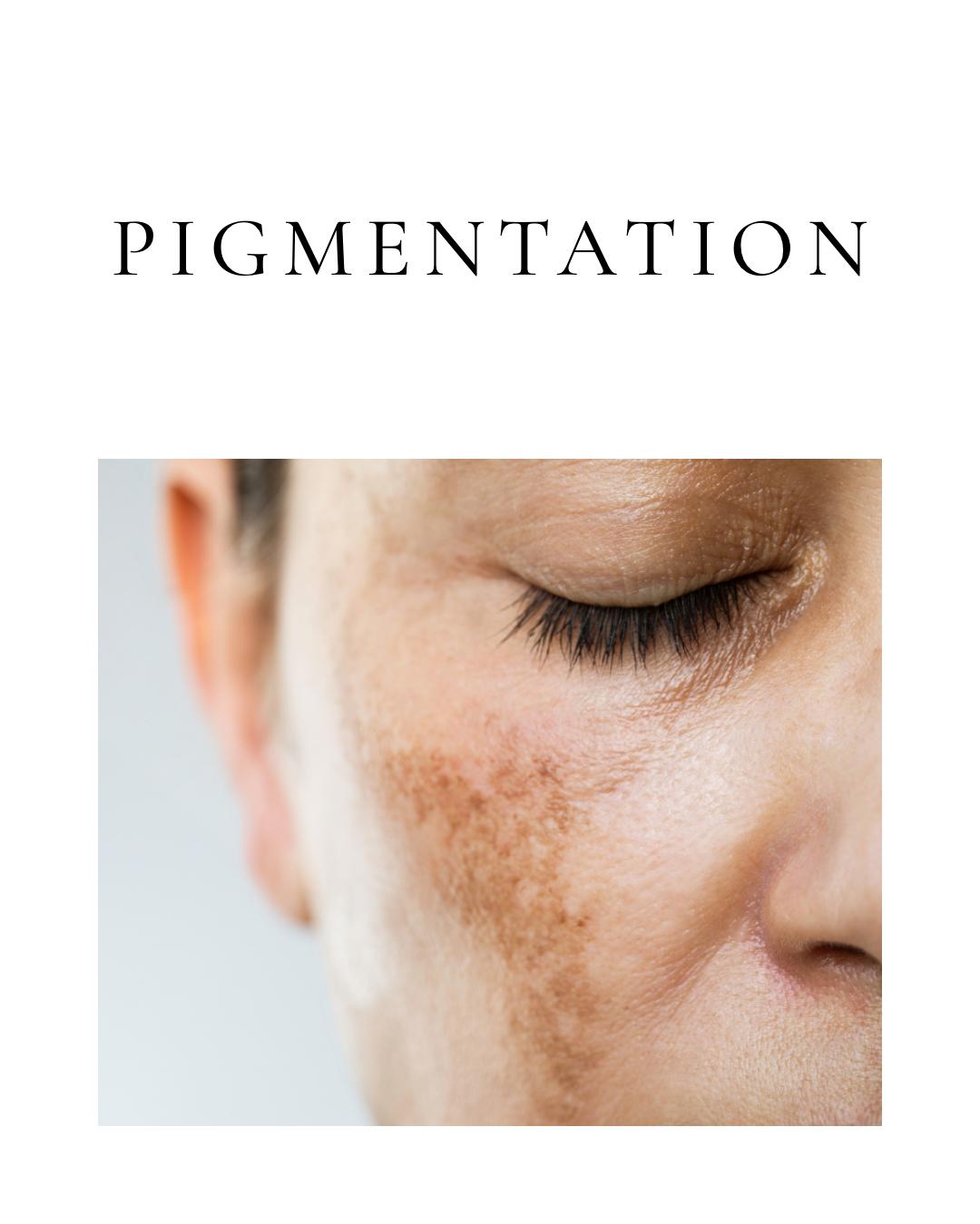 Pigmentation
