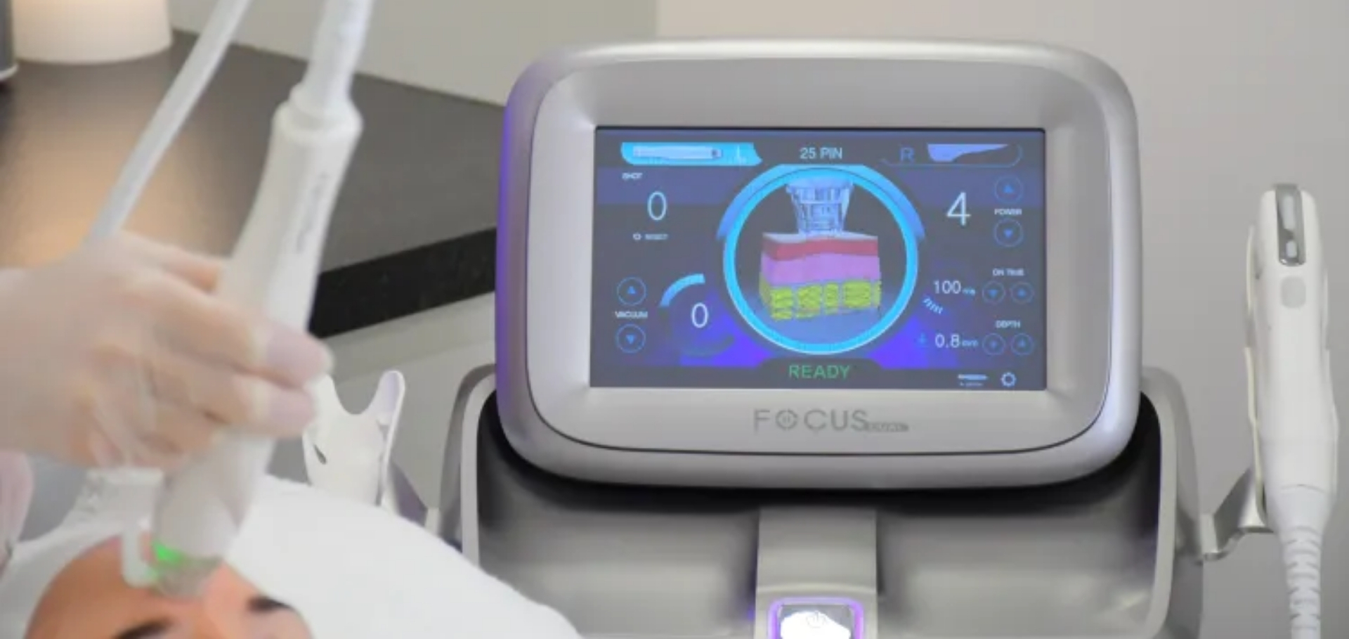 RF Micro-Needling