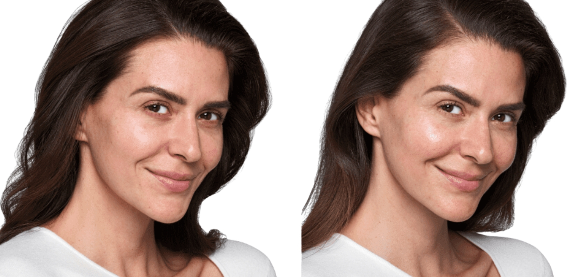 Skin Booster